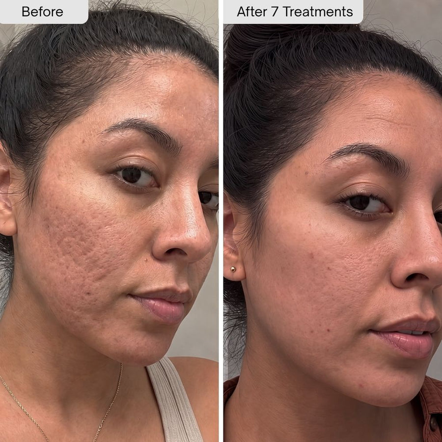 Boxcar Scars and Uneven Texture customer transformation